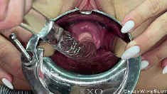 Thumbnail of Crazywifeslut Fuck Her Cervix With Glass Dildo