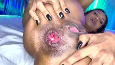 Thumbnail of Flexi Milf Prolapse Her Destroyed Anus