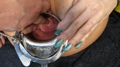Thumbnail of Cervix Fingering