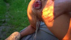 Thumbnail of Extreme Anal Outdoor