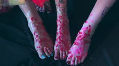 Thumbnail of Love How Hot Wax Feels On My Feet